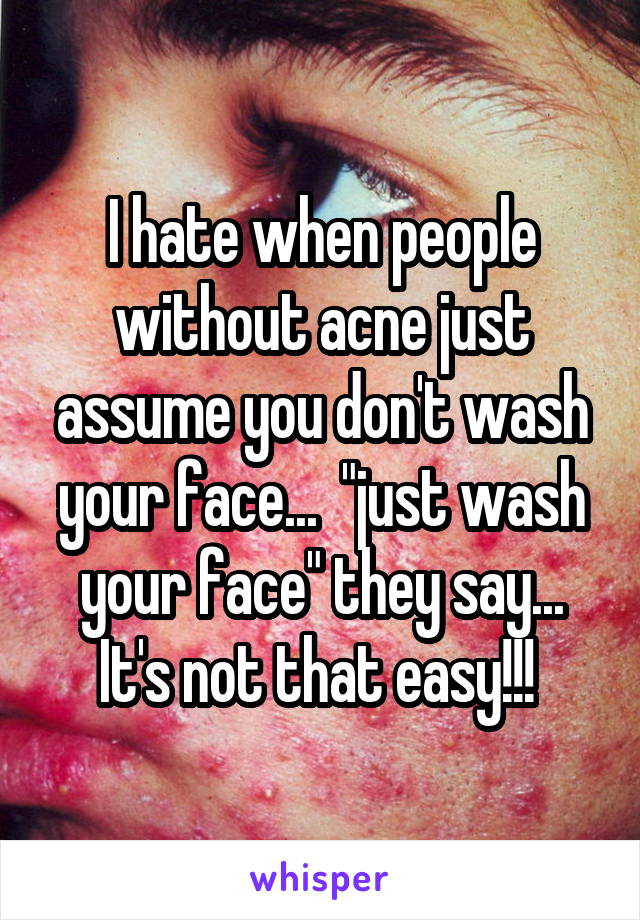 I hate when people without acne just assume you don't wash your face...  "just wash your face" they say... It's not that easy!!! 