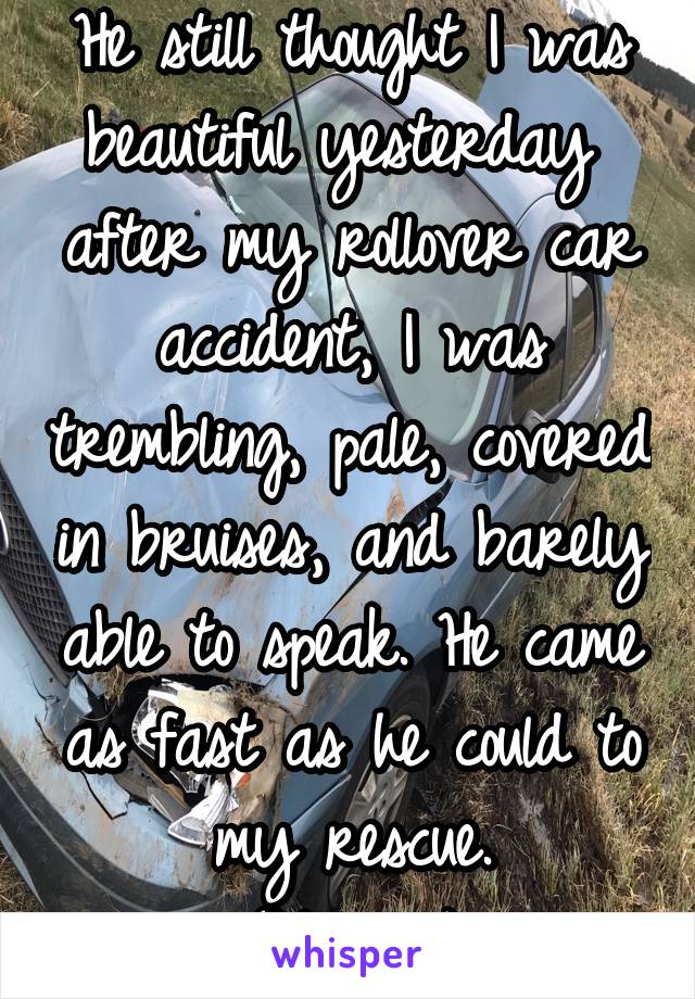 He still thought I was beautiful yesterday  after my rollover car accident, I was trembling, pale, covered in bruises, and barely able to speak. He came as fast as he could to my rescue.
(My pic)