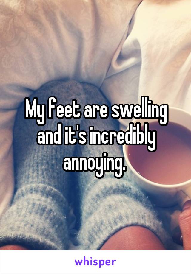 My feet are swelling and it's incredibly annoying. 