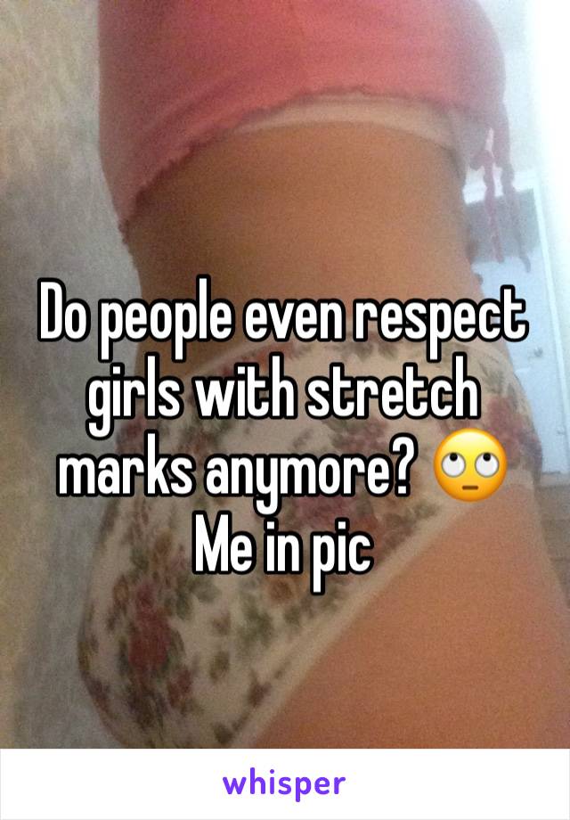 Do people even respect girls with stretch marks anymore? 🙄 
Me in pic