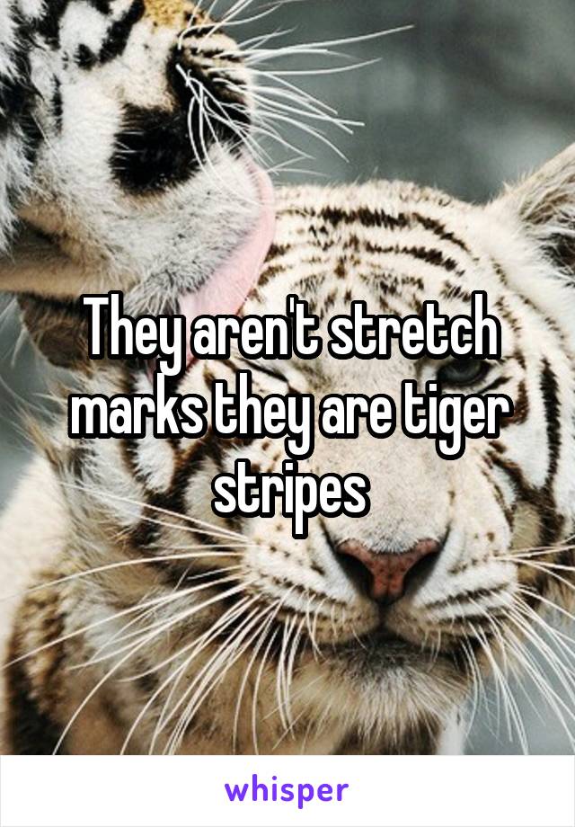 They aren't stretch marks they are tiger stripes