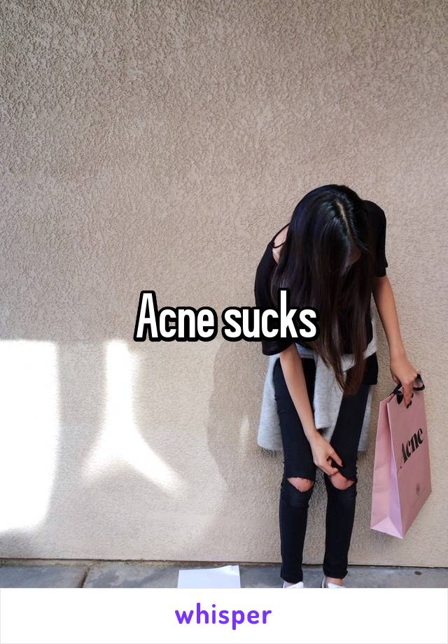 Acne sucks