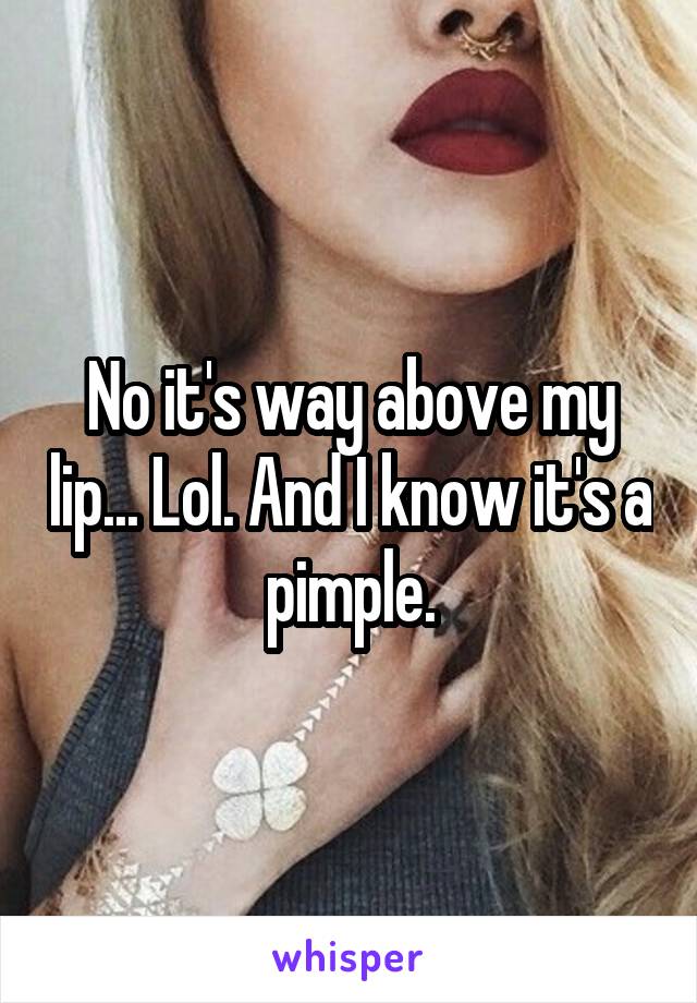 No it's way above my lip... Lol. And I know it's a pimple.
