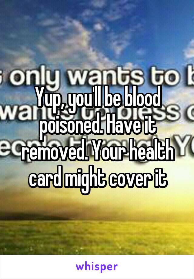 Yup, you'll be blood poisoned. Have it removed. Your health card might cover it