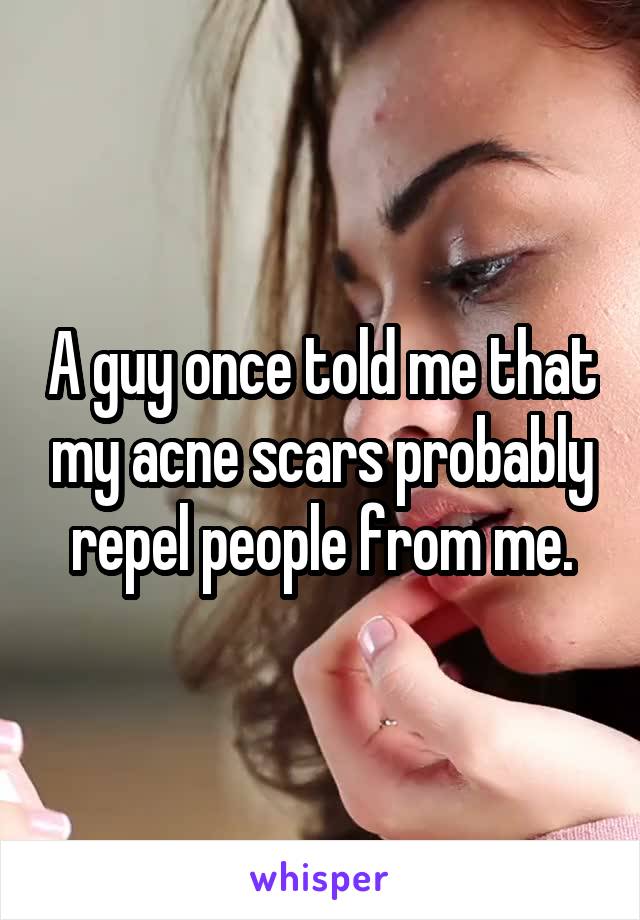 A guy once told me that my acne scars probably repel people from me.