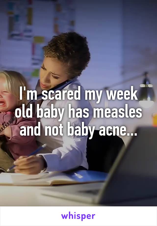 I'm scared my week old baby has measles and not baby acne...