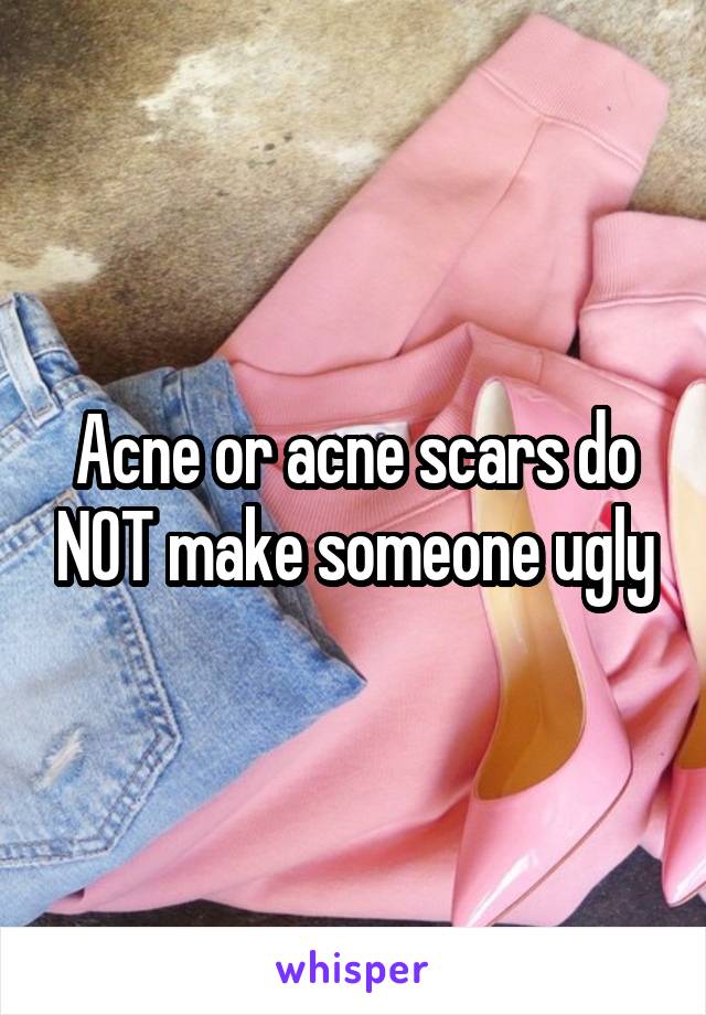 Acne or acne scars do NOT make someone ugly