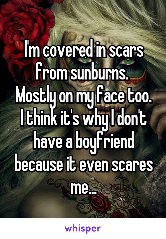 I'm covered in scars from sunburns. 
Mostly on my face too. I think it's why I don't have a boyfriend because it even scares me...