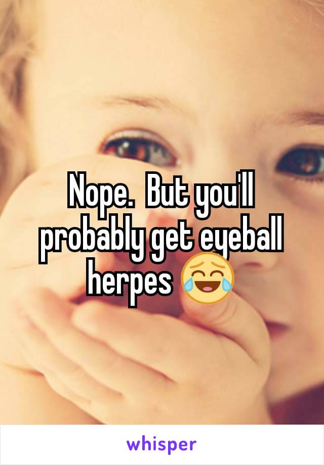 Nope.  But you'll probably get eyeball herpes 😂