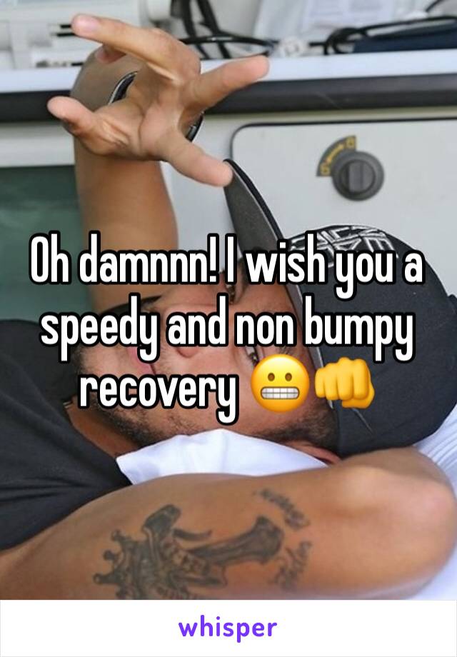 Oh damnnn! I wish you a speedy and non bumpy recovery 😬👊