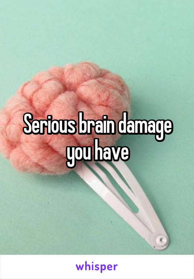 Serious brain damage you have