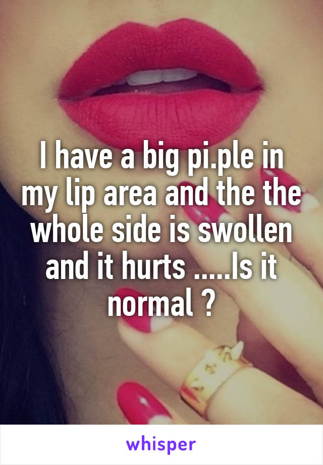 I have a big pi.ple in my lip area and the the whole side is swollen and it hurts .....Is it normal ?