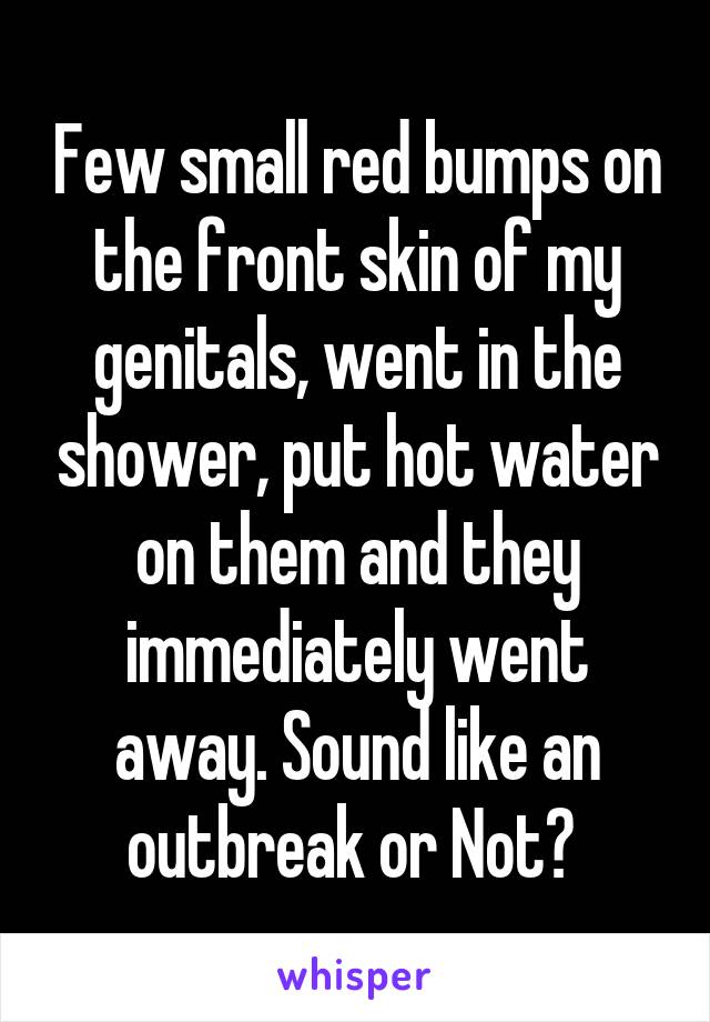 Few small red bumps on the front skin of my genitals, went in the shower, put hot water on them and they immediately went away. Sound like an outbreak or Not? 