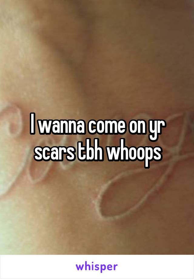 I wanna come on yr scars tbh whoops