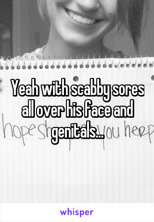 Yeah with scabby sores all over his face and genitals...