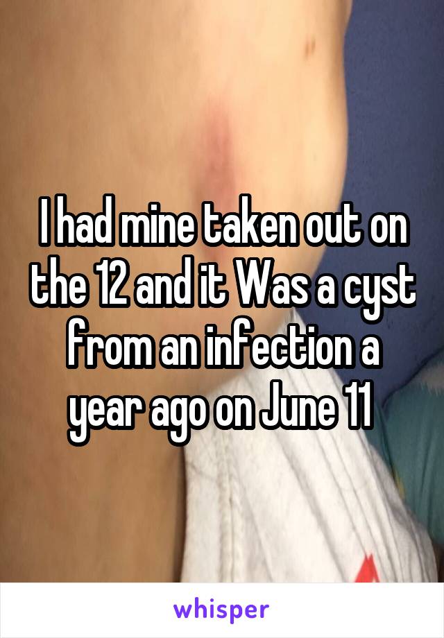 I had mine taken out on the 12 and it Was a cyst from an infection a year ago on June 11 