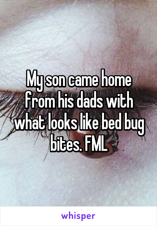 My son came home from his dads with what looks like bed bug bites. FML