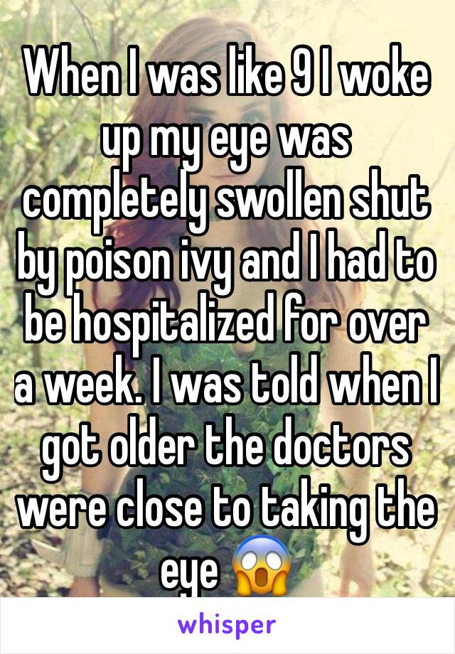 When I was like 9 I woke up my eye was completely swollen shut by poison ivy and I had to be hospitalized for over a week. I was told when I got older the doctors were close to taking the eye 😱