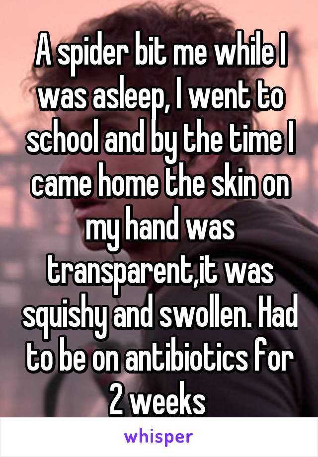 A spider bit me while I was asleep, I went to school and by the time I came home the skin on my hand was transparent,it was squishy and swollen. Had to be on antibiotics for 2 weeks 