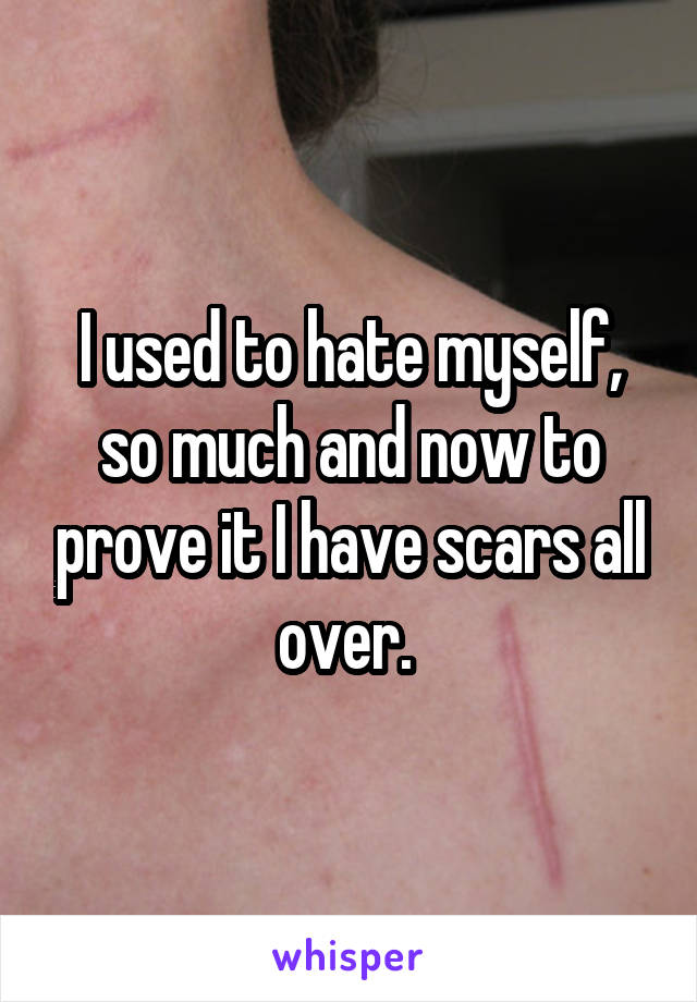 I used to hate myself, so much and now to prove it I have scars all over. 