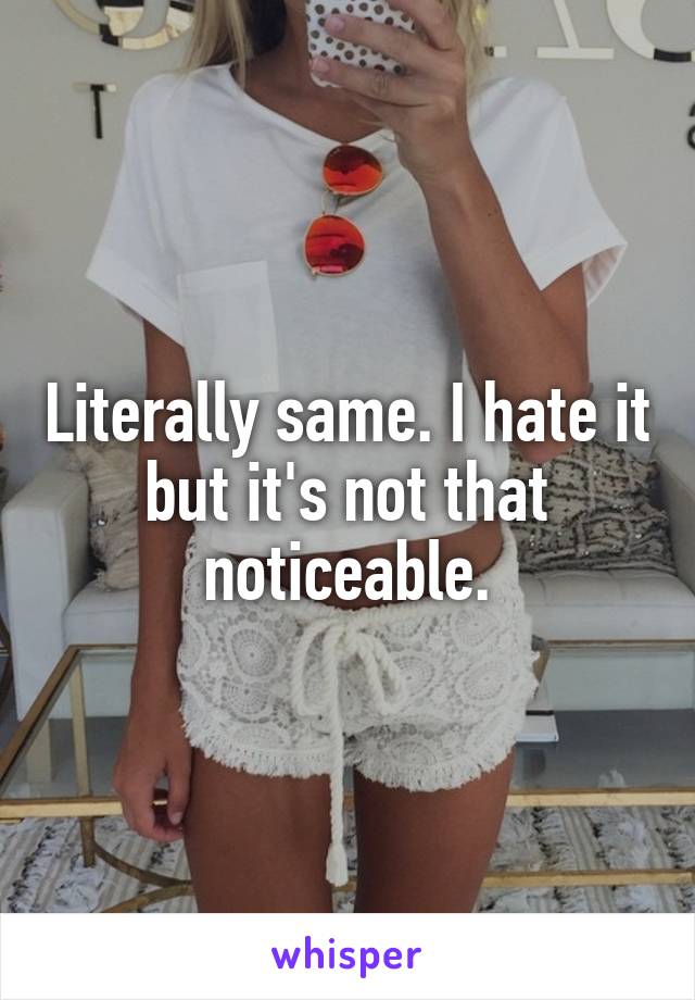 Literally same. I hate it but it's not that noticeable.