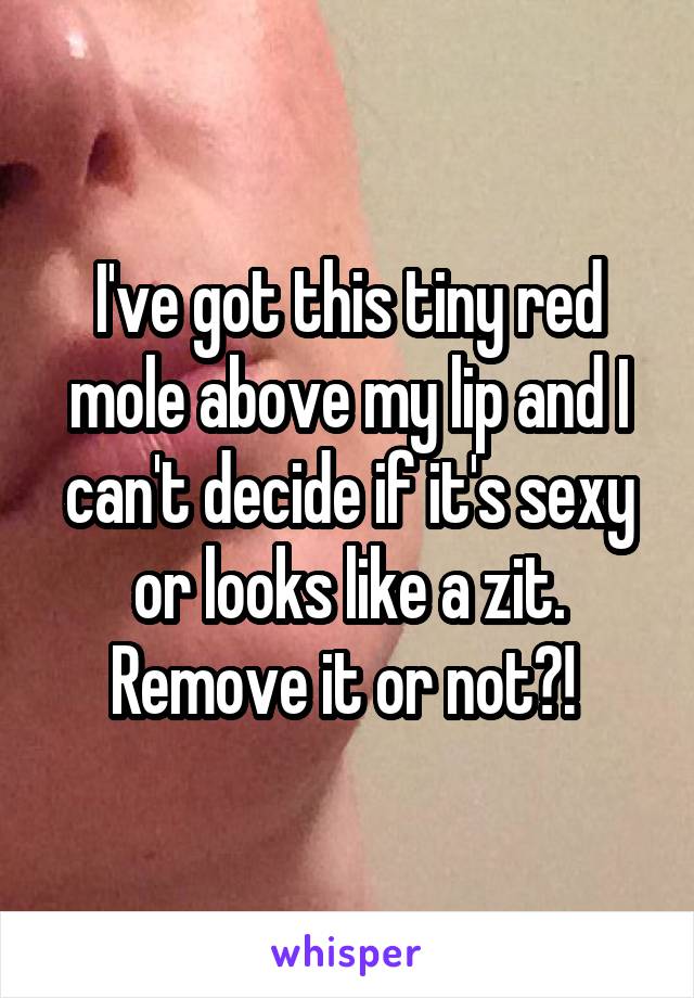 I've got this tiny red mole above my lip and I can't decide if it's sexy or looks like a zit. Remove it or not?! 