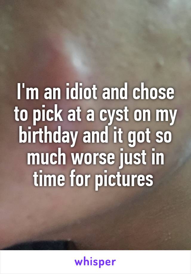 I'm an idiot and chose to pick at a cyst on my birthday and it got so much worse just in time for pictures 