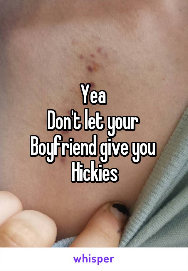 Yea 
Don't let your 
Boyfriend give you 
Hickies