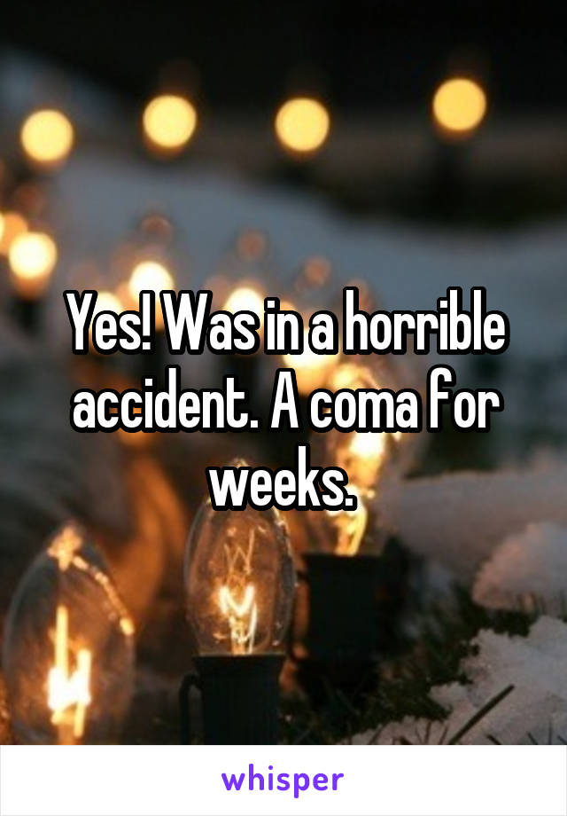Yes! Was in a horrible accident. A coma for weeks. 