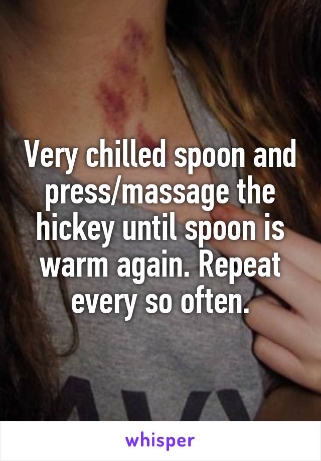 Very chilled spoon and press/massage the hickey until spoon is warm again. Repeat every so often.