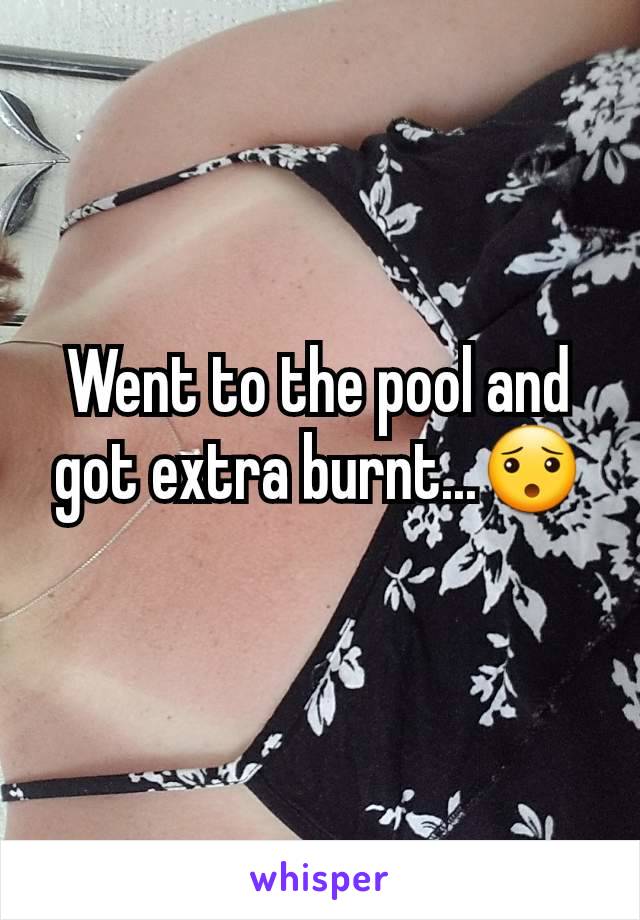 Went to the pool and got extra burnt...😯