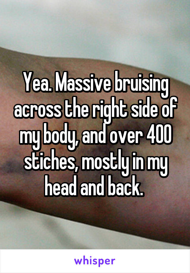 Yea. Massive bruising across the right side of my body, and over 400 stiches, mostly in my head and back. 