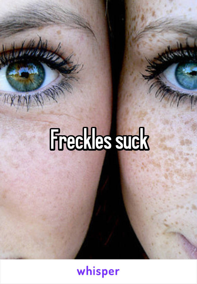 Freckles suck