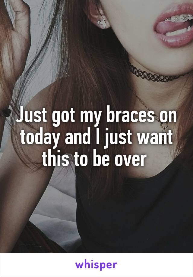 Just got my braces on today and I just want this to be over 