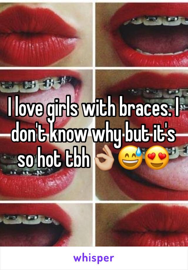 I love girls with braces. I don't know why but it's so hot tbh👌🏼😅😍