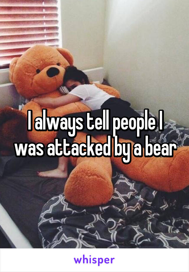 I always tell people I was attacked by a bear