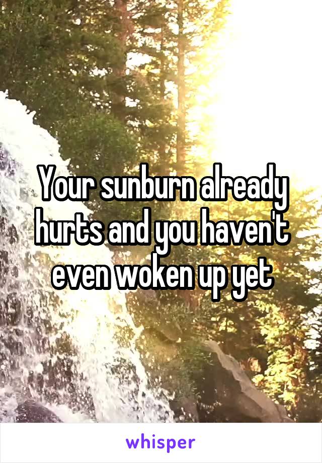 Your sunburn already hurts and you haven't even woken up yet