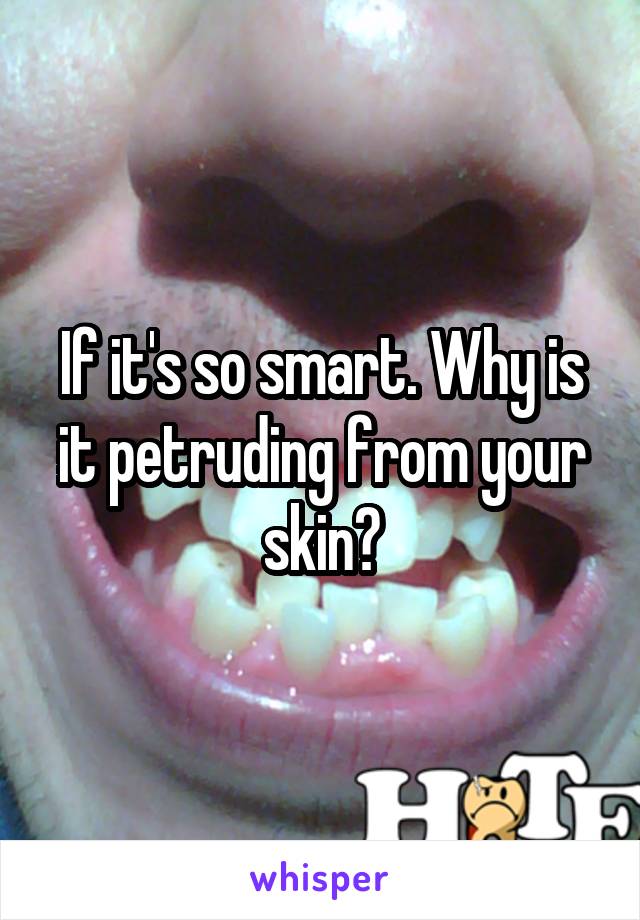 If it's so smart. Why is it petruding from your skin?