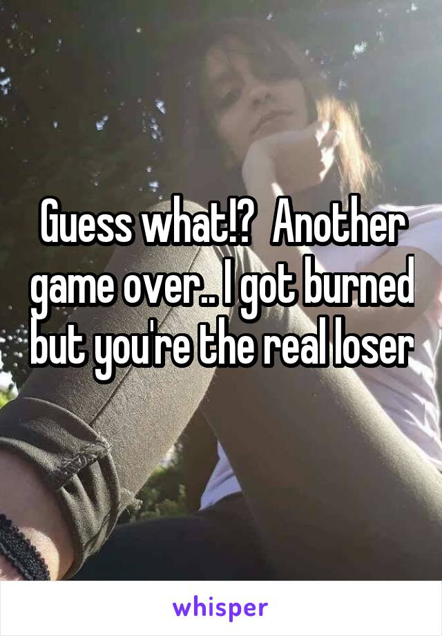 Guess what!?  Another game over.. I got burned but you're the real loser 