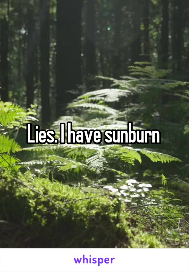 Lies. I have sunburn 