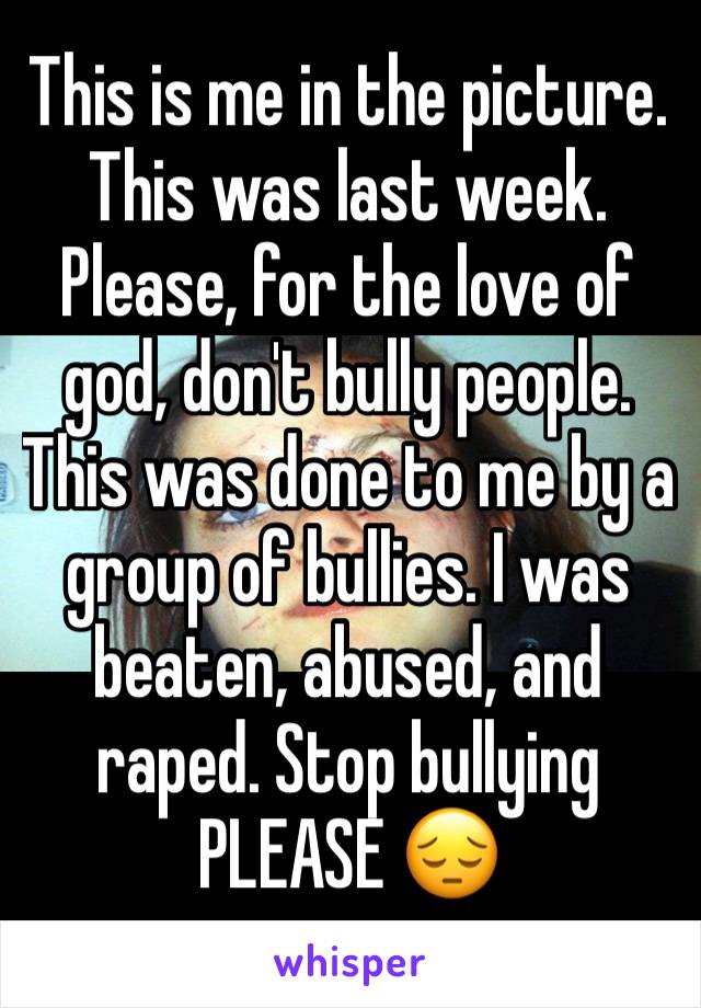 This is me in the picture. This was last week. Please, for the love of god, don't bully people. This was done to me by a group of bullies. I was beaten, abused, and raped. Stop bullying PLEASE 😔