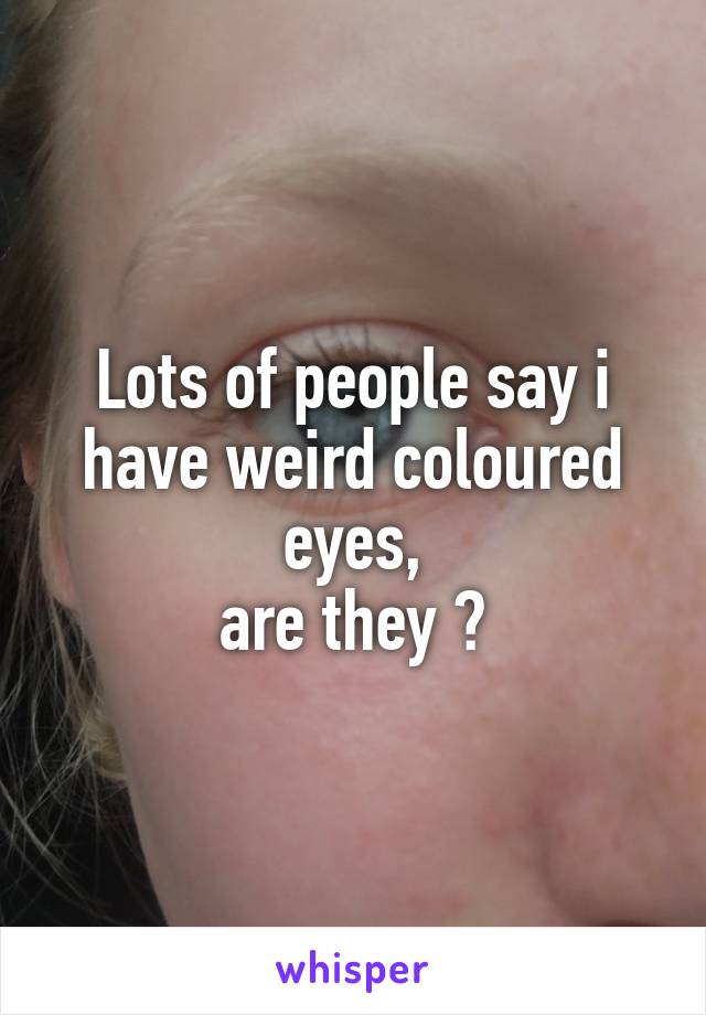 Lots of people say i have weird coloured eyes,
are they ?