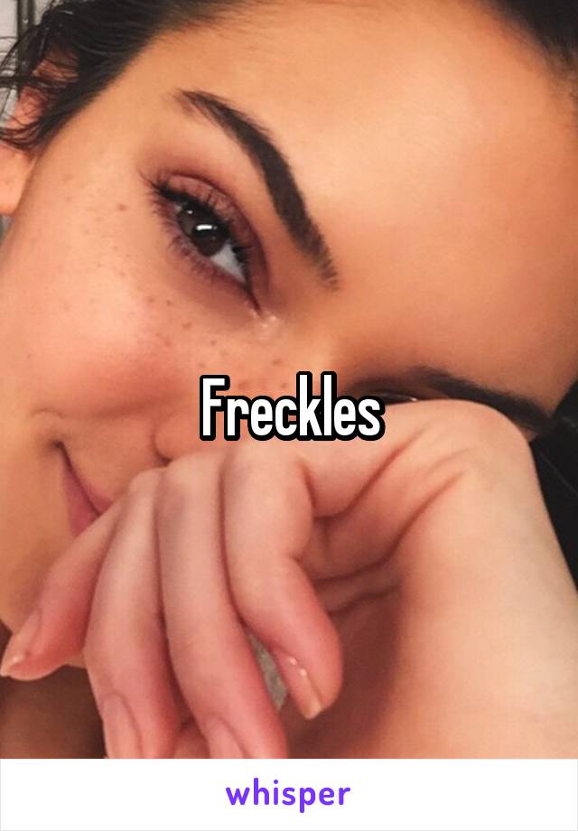 Freckles