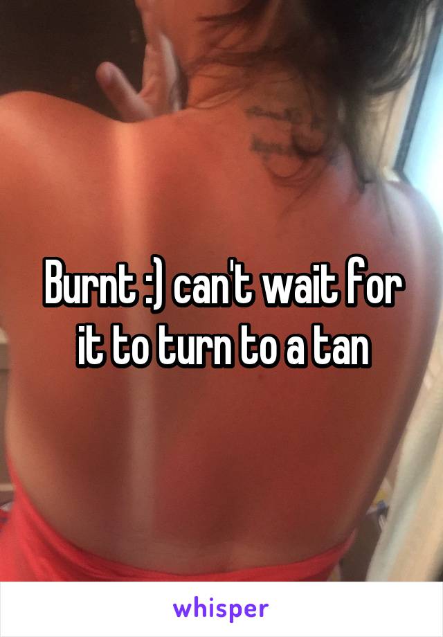 Burnt :) can't wait for it to turn to a tan