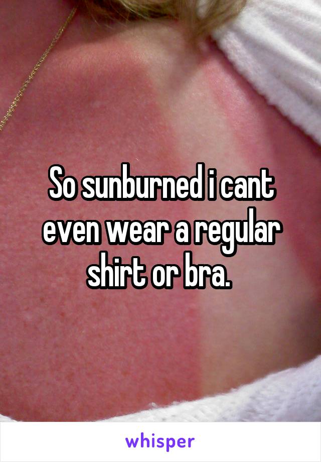 So sunburned i cant even wear a regular shirt or bra. 