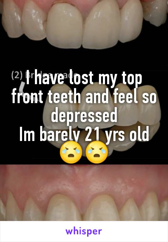 I have lost my top front teeth and feel so depressed
Im barely 21 yrs old 😭😭