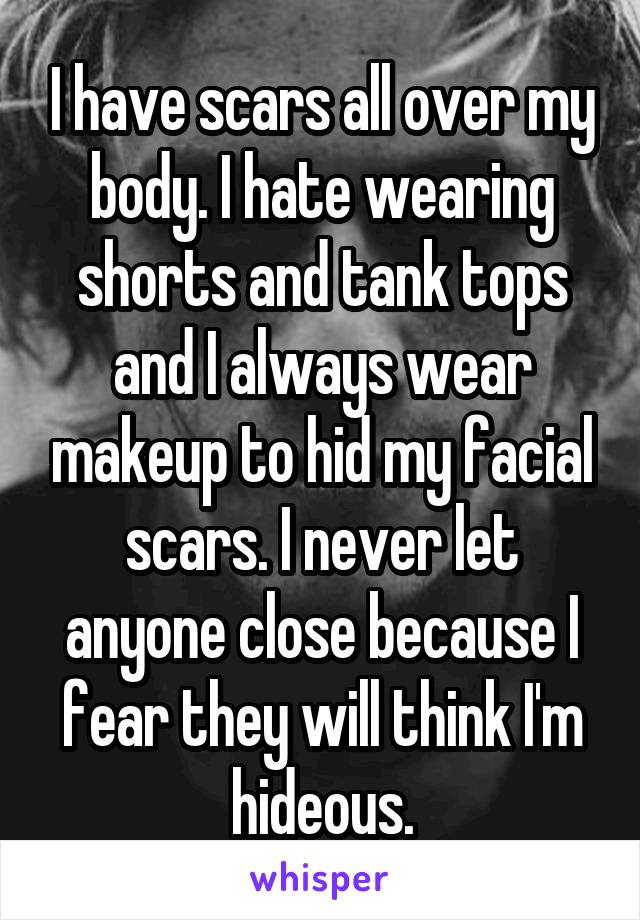 I have scars all over my body. I hate wearing shorts and tank tops and I always wear makeup to hid my facial scars. I never let anyone close because I fear they will think I'm hideous.