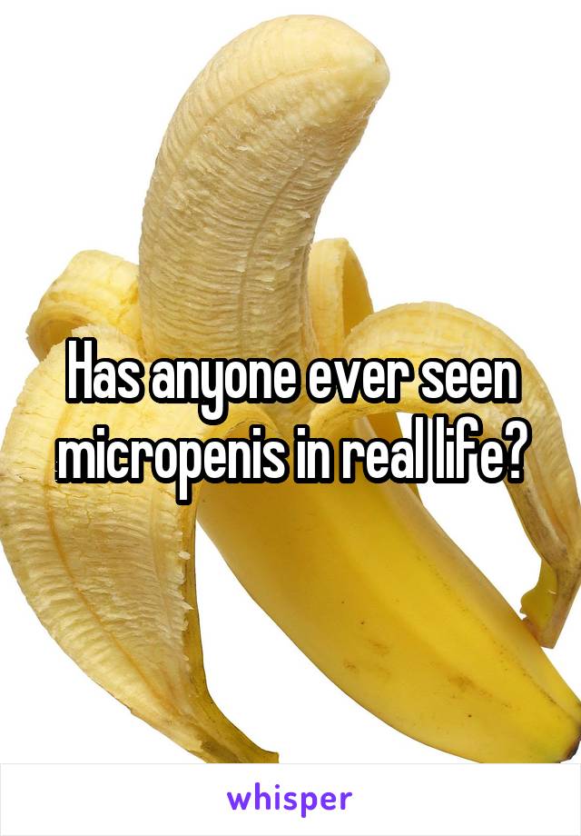 Has anyone ever seen micropenis in real life?