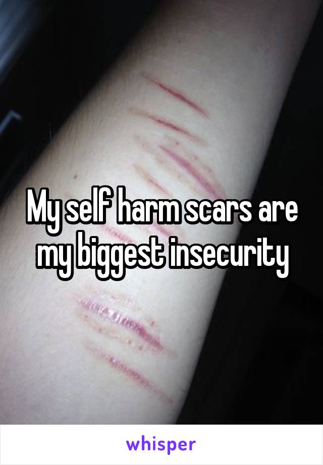 My self harm scars are my biggest insecurity