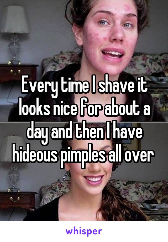 Every time I shave it looks nice for about a day and then I have hideous pimples all over 